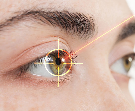 refractive surgery